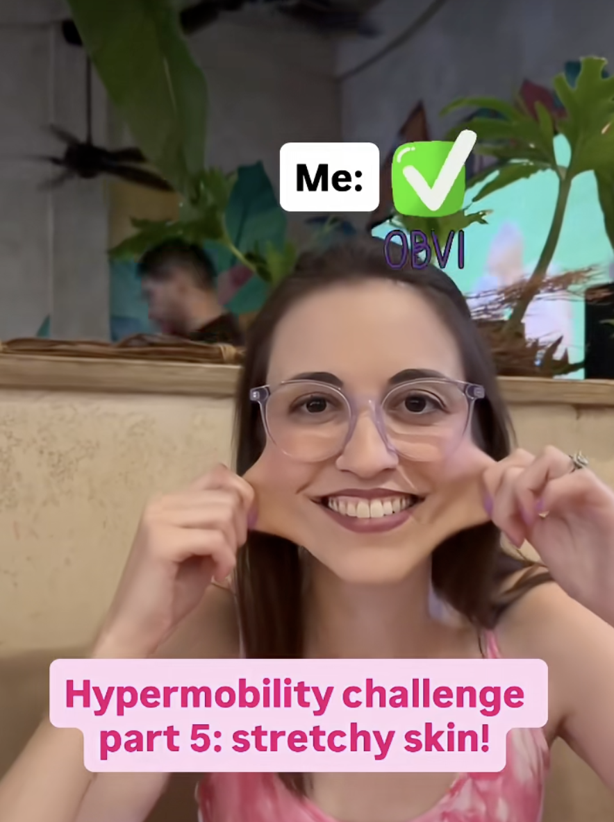Hypermobility challenge part 5: stretchy skin